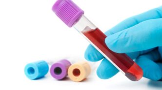 фото: пробірки з кровʼю – аналіз на вітамін В12